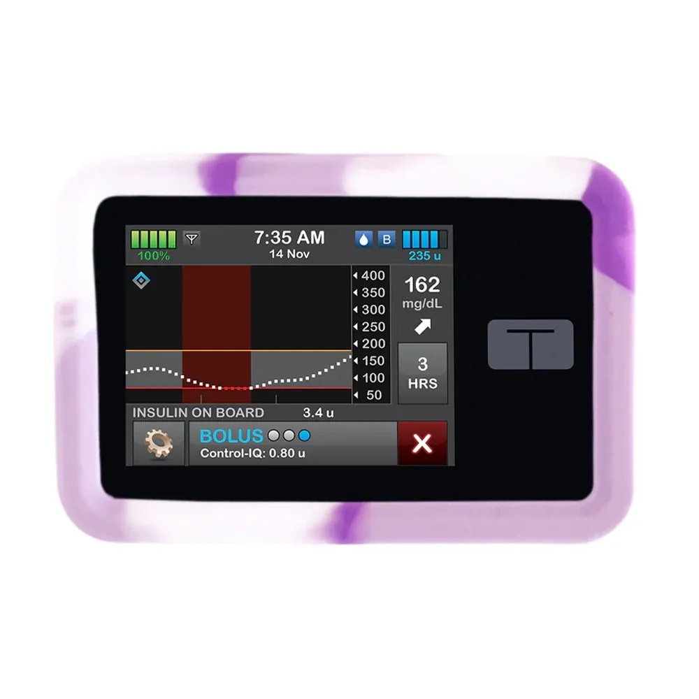 Tandem T:SLIM Pump Gel Skin Case | Sugar Medical