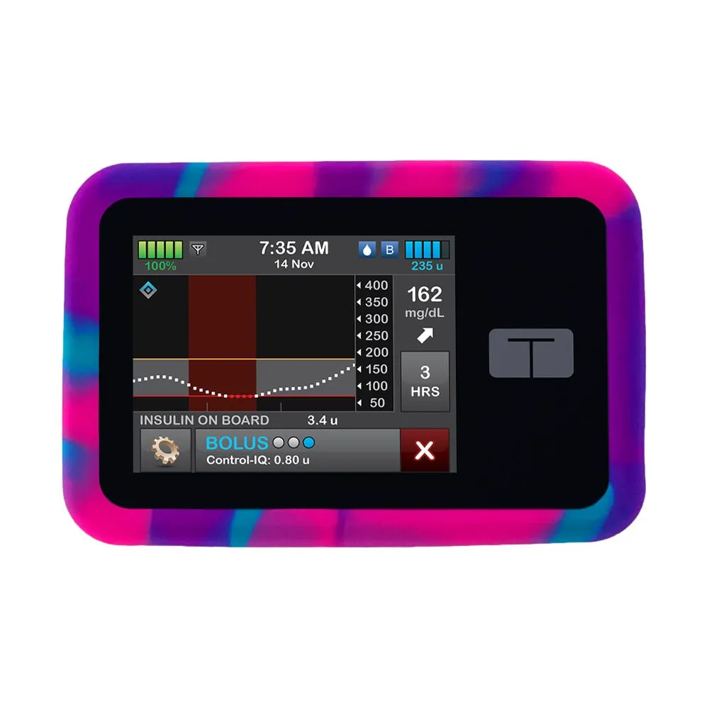 Tandem T:SLIM Pump Gel Skin Case | Sugar Medical
