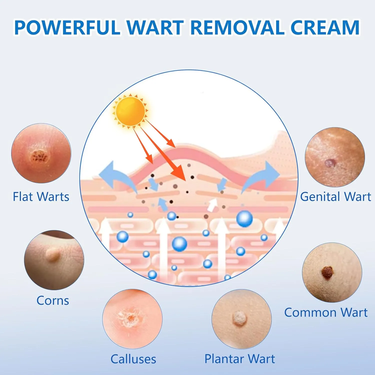 Wart Remover Fast Acting Gel – Strong Freeze Off Treatment for Genital, Plantar, Common Warts, Corns, and Flat Wart -RED-（2PC）